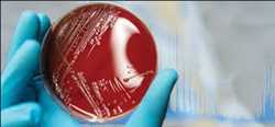 Global Clinical Microbiology Market Trends