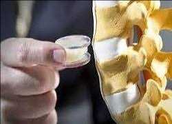 Global Spinal Implants and Surgical Devices Market