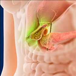 Global Gallbladder Treatment Market