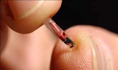 Bio-Chips Market