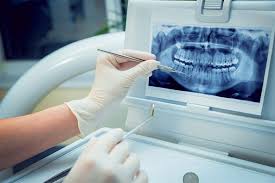 Radiographie dentaire Market