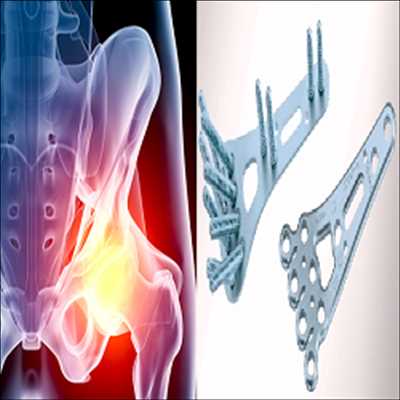 Orthopedic Trauma Devices Market